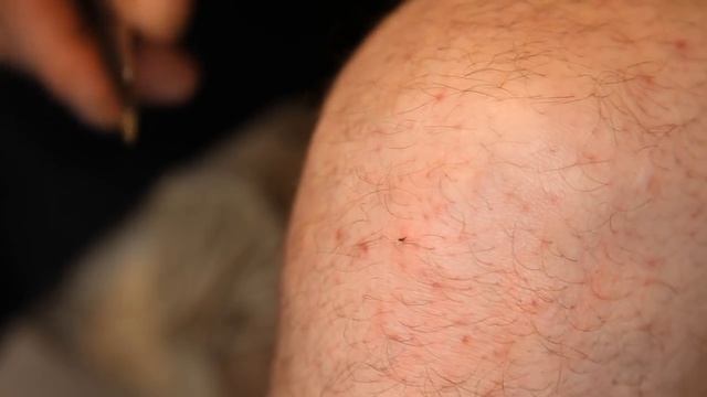 Лечим колено пчелиным ядом
