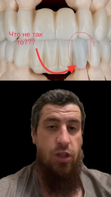 Ну же 🤔думаю тут больше правильных ответом будет, как ни как почти все ролики обучающие тут 🥸