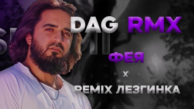 SHAMI - Фея x REMIX ЛЕЗГИНКА