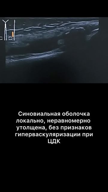 #синовит