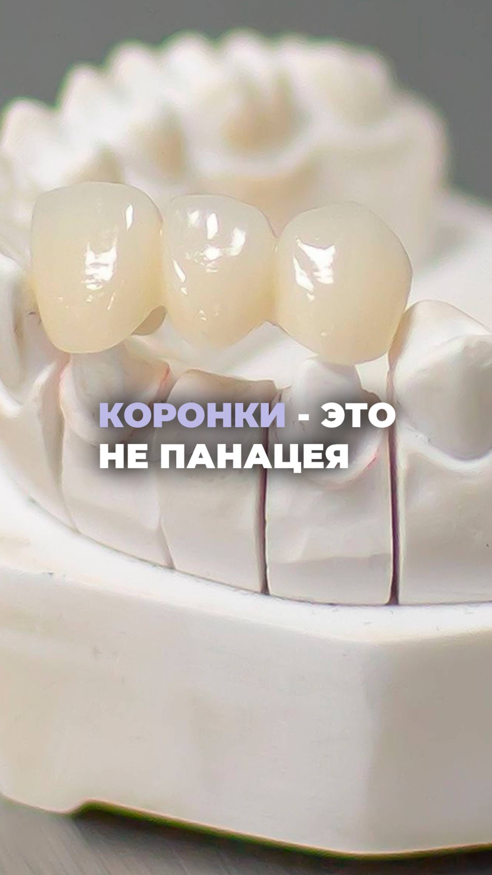 Коронки - это не панацея!