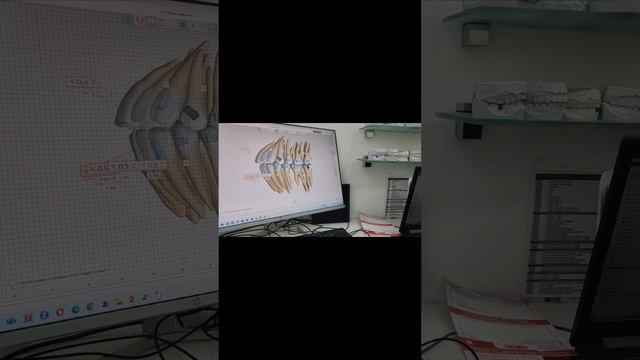 Почему так долго происходит подготовка перед началом лечения?