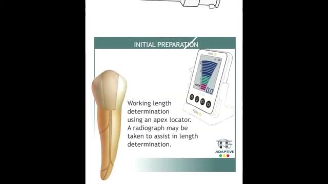 ApexID   Digital Apex Locator