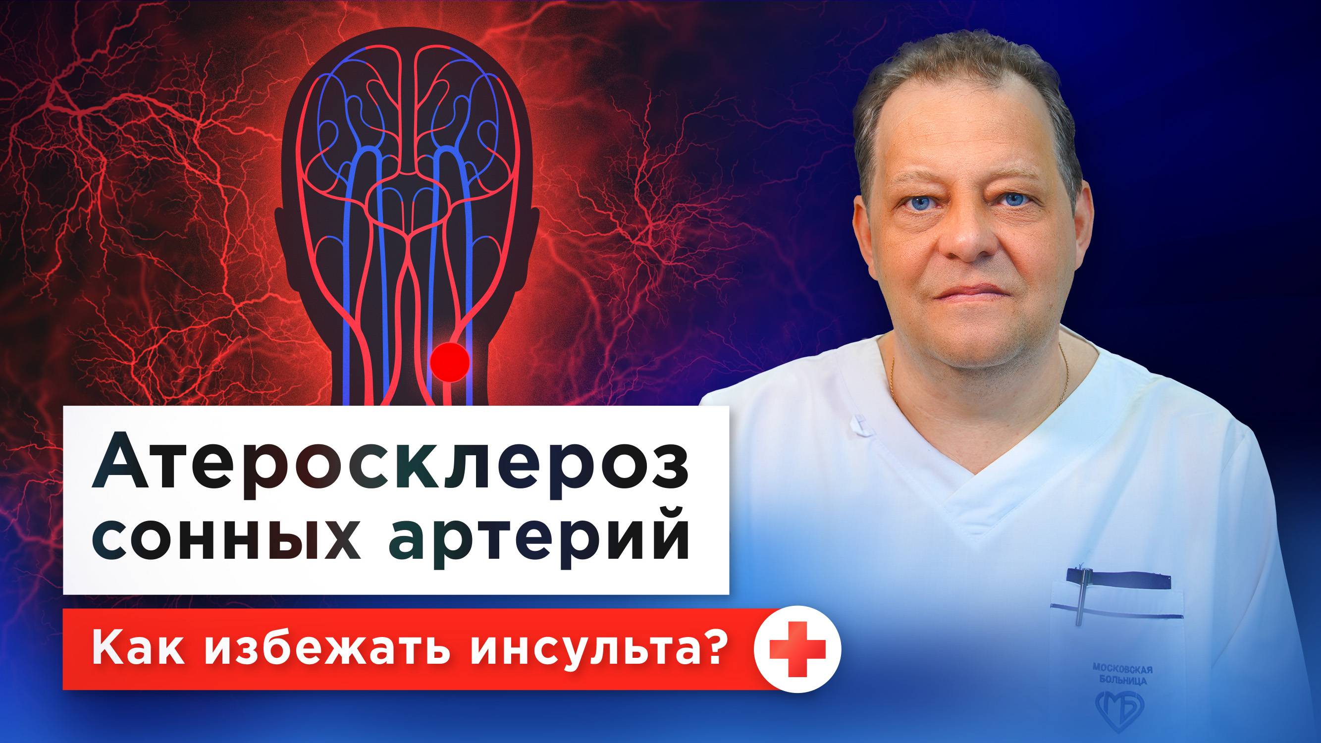 Холестерин, бляшки, инсульт... Все о профилактике и лечении атеросклероза сонных артерий