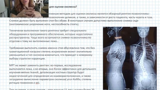 Как выглядит обзорный рентген позвоночника и почему нам важно делать именно такой рентген.