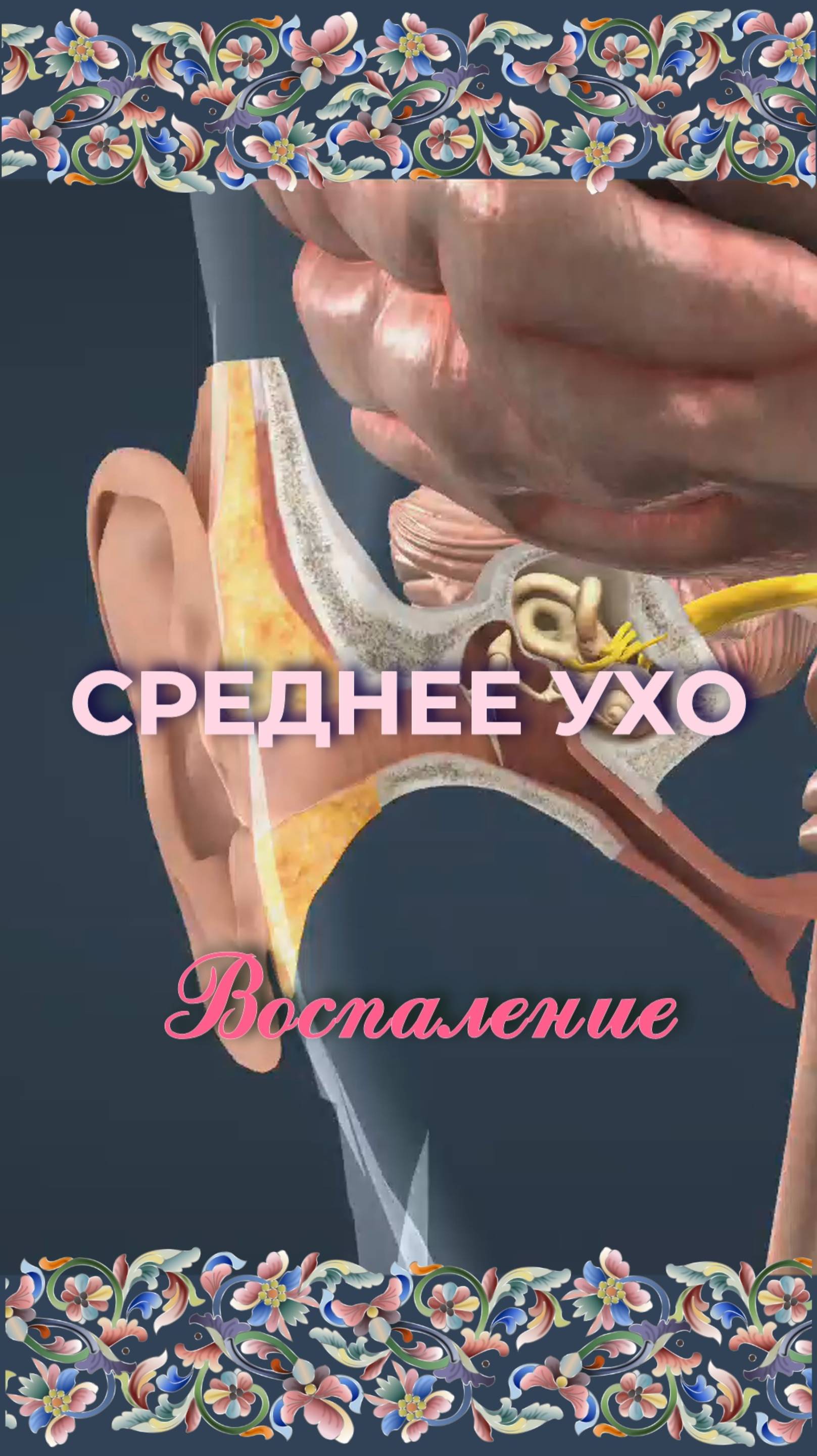 Воспаление среднего уха - Средний отит