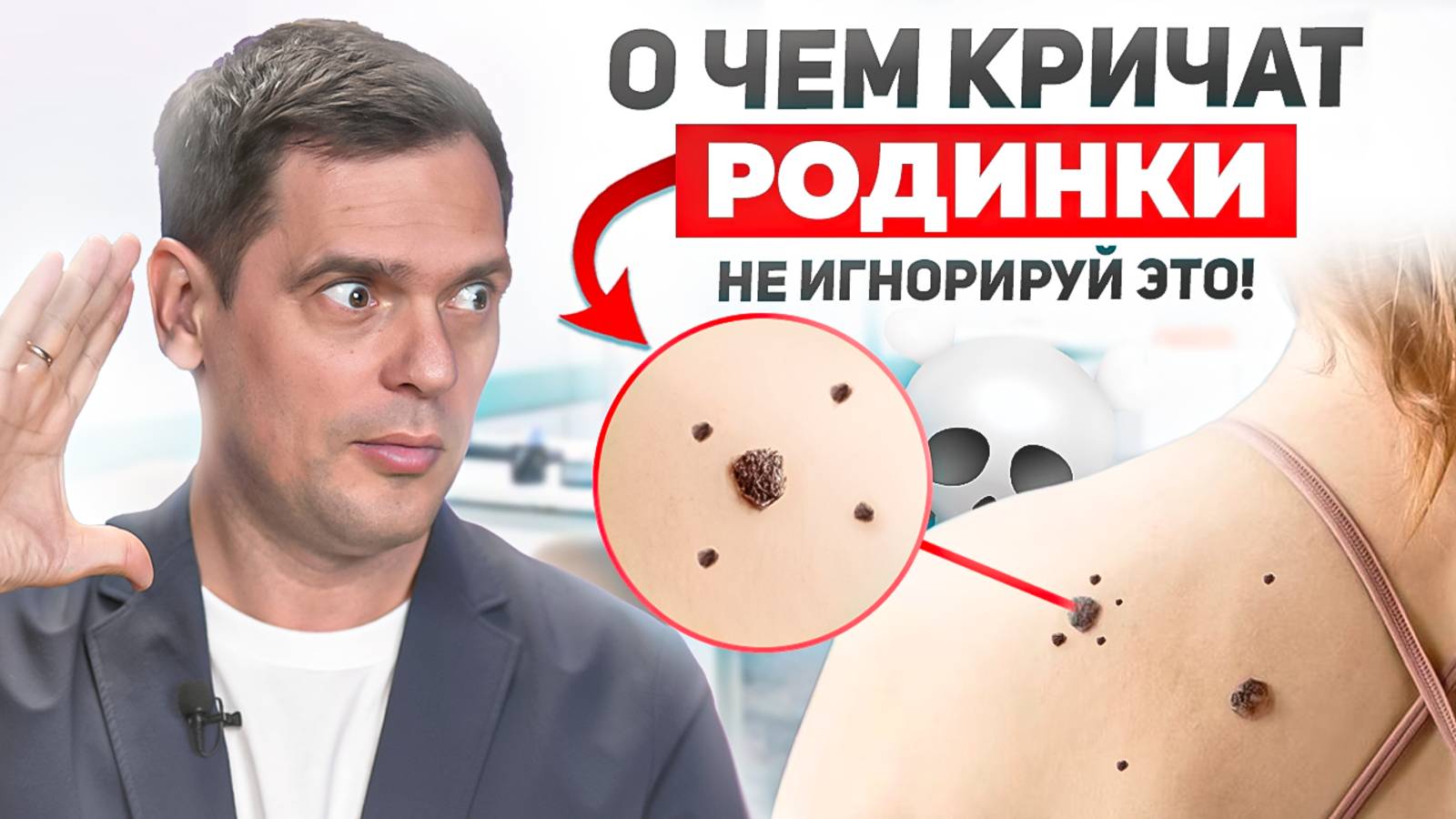 Родинка - это СИГНАЛ! Не игнорируй его!