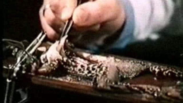 нервная клетка