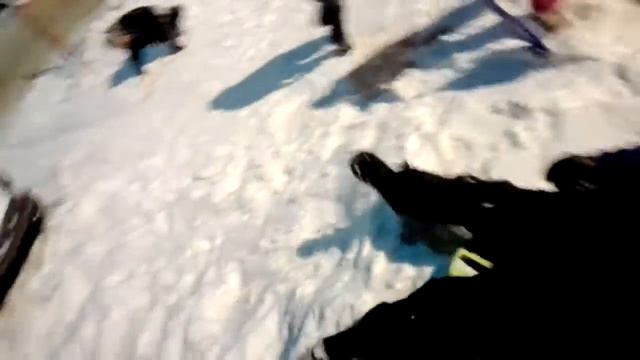 Шок мальчик попал под машину что с ним будет?