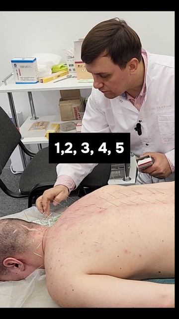 90 иголок заменяет 50 сеансов массажа!  Только в Центре Касимова Искандера #лечение #польза