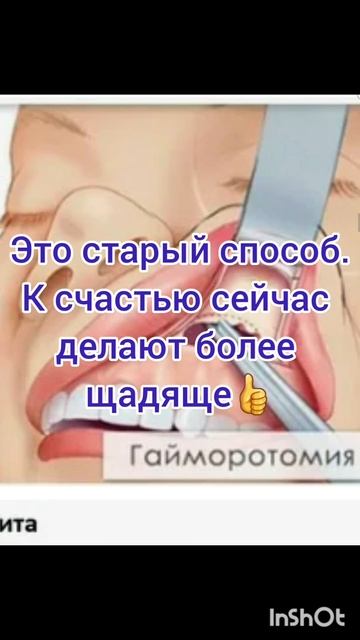 ПроЗдоровье.Операция на верхнечелюстной пазухе.Фильм1.Серия5.Часть5 .mp4
