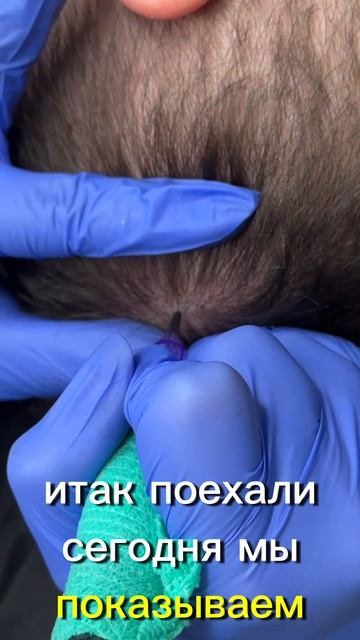 Загущение волос