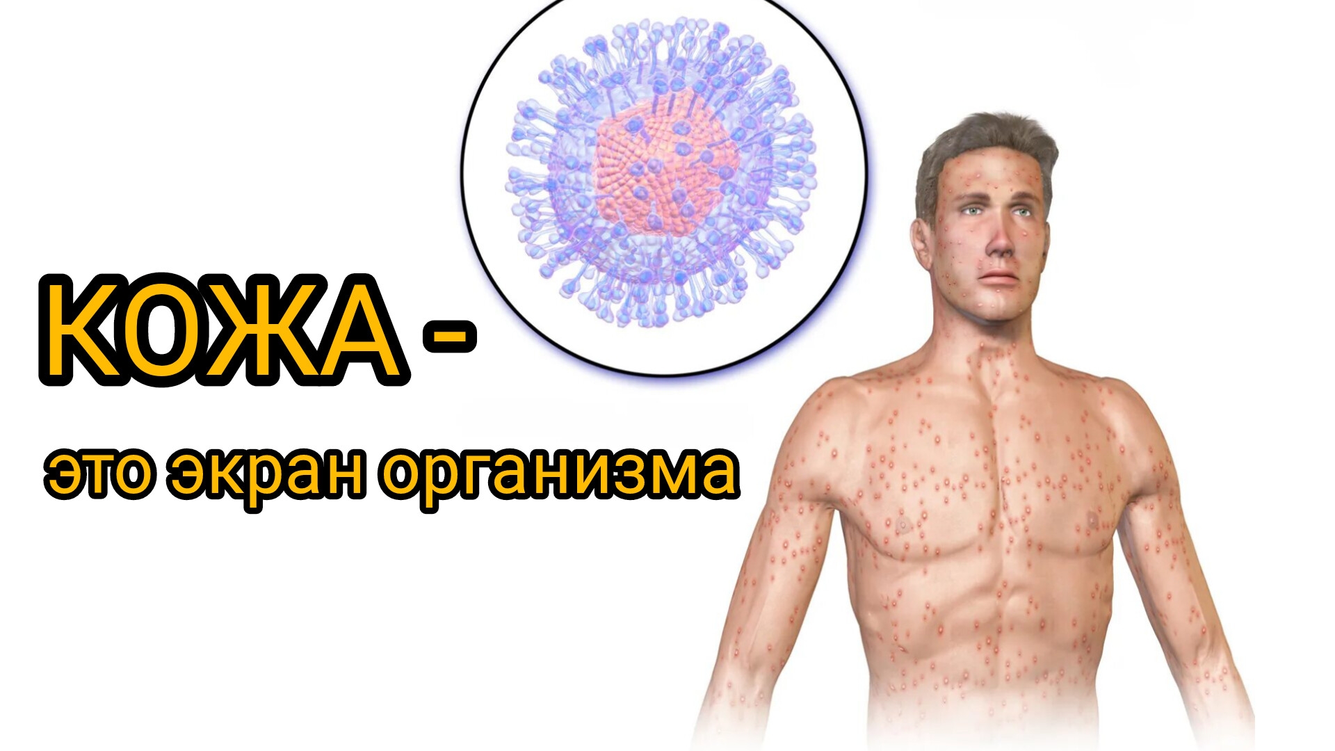 Из-за чего происходят высыпания на теле?