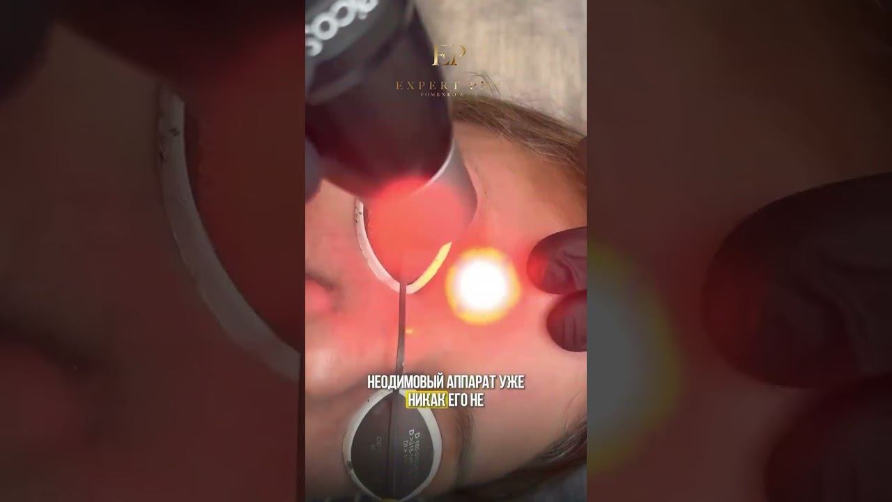 Сводим зеленоватые брови  #microblading #beauty #brows