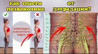 Лордоз поясницы душит нервы и сосуды ног, половых органов. Методы оздоровления позвоночника