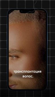 Мужская косметология становится популярнее