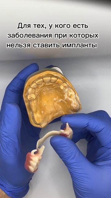 Зубной протез #dental #dentist #doctor #протезированиезубов #протез