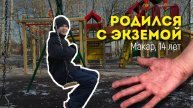 Жизнь с экземой - моя история | рецепт лечения за 2 недели