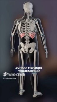 ГРЫЖИ в пояснице_ Сделай ТЕСТ на диафрагму!