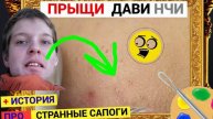 Прыщи 035 Черные Точки ОБСЫПАЛИ лоб Восточной Красотки. Спасает Косметолог, который всё выдавит. Ист