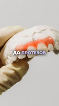 Когда стоматолог предлагает исправить твою ситуацию