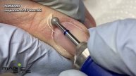 АЛМАЗНЫЙ ШАР 3.5 ММ СРЕДНЕГО АБРАЗИВА