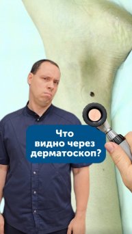 Что видно через дерматоскоп?