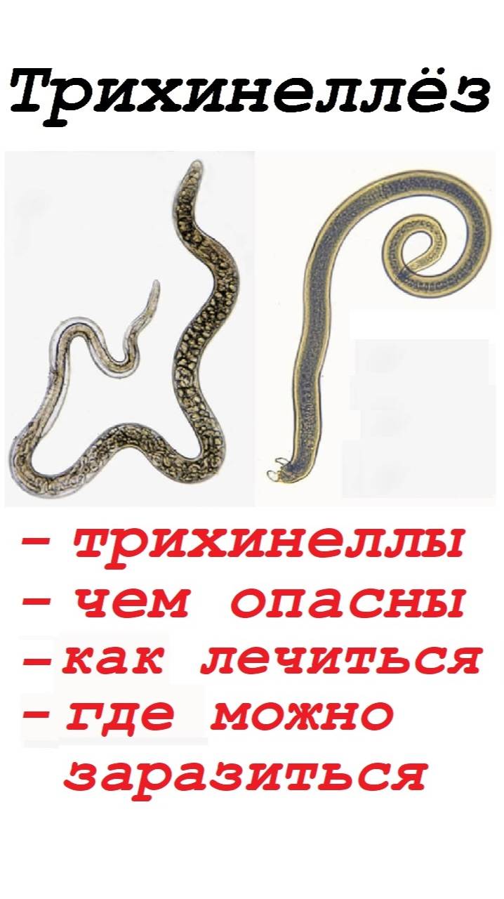 Дикая природа. Трихинеллёз. Быстрый и беспощадный убийца