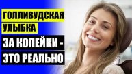 😀 Виниры для зубов перфект смайл 🔵 Сколько стоит поставить винир на 1 зуб