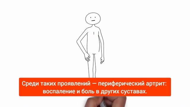Не АксСпа ли это?