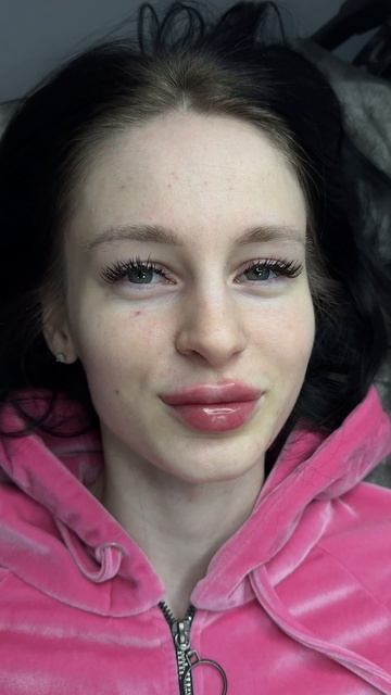 Кп губы