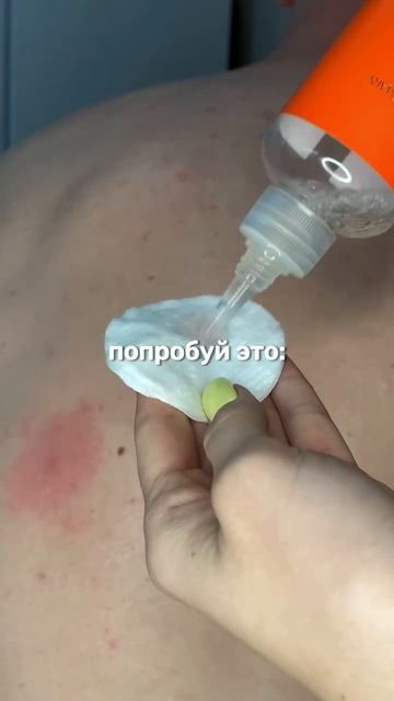 Муж  давит прыщи ?