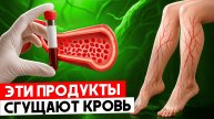 20 продуктов, которые сгущают кровь — едим каждый день и не подозреваем