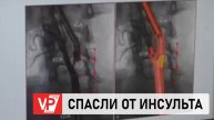 ВОЛГОГРАДСКИЕ ВРАЧИ СПАСЛИ МУЖЧИНУ ОТ ПОВТОРНОГО ИНСУЛЬТА