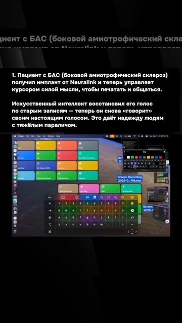 Чип Neuralink