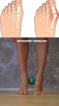 Начни делать эти упражнения для стоп. Подпишись и читай описание ✅