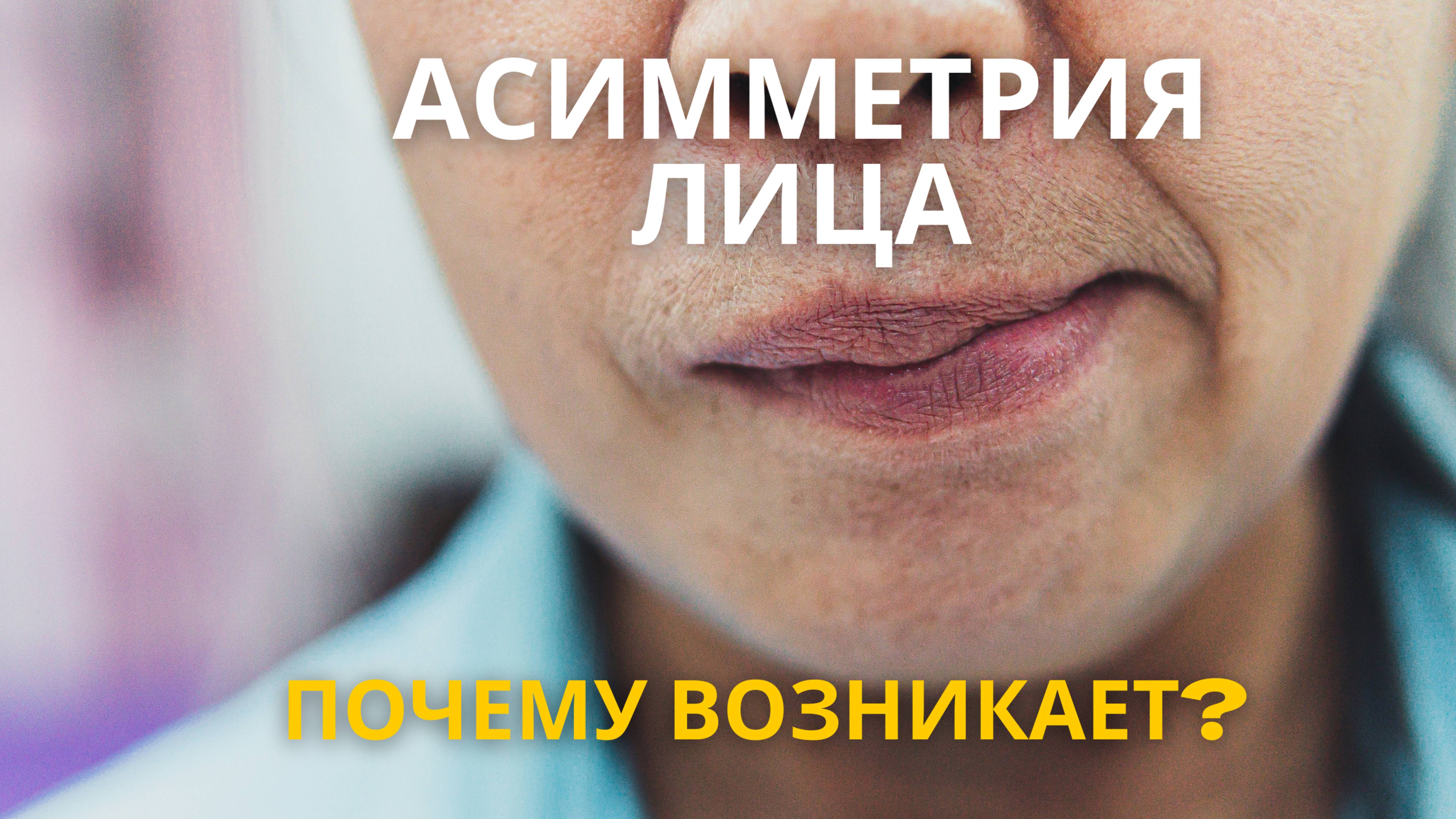 Асимметрия лица, причины