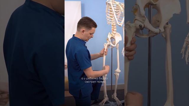 Мой ребёнок косолапит - часть 2