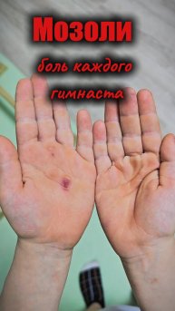 Мозоли - боль каждого гимнаста!