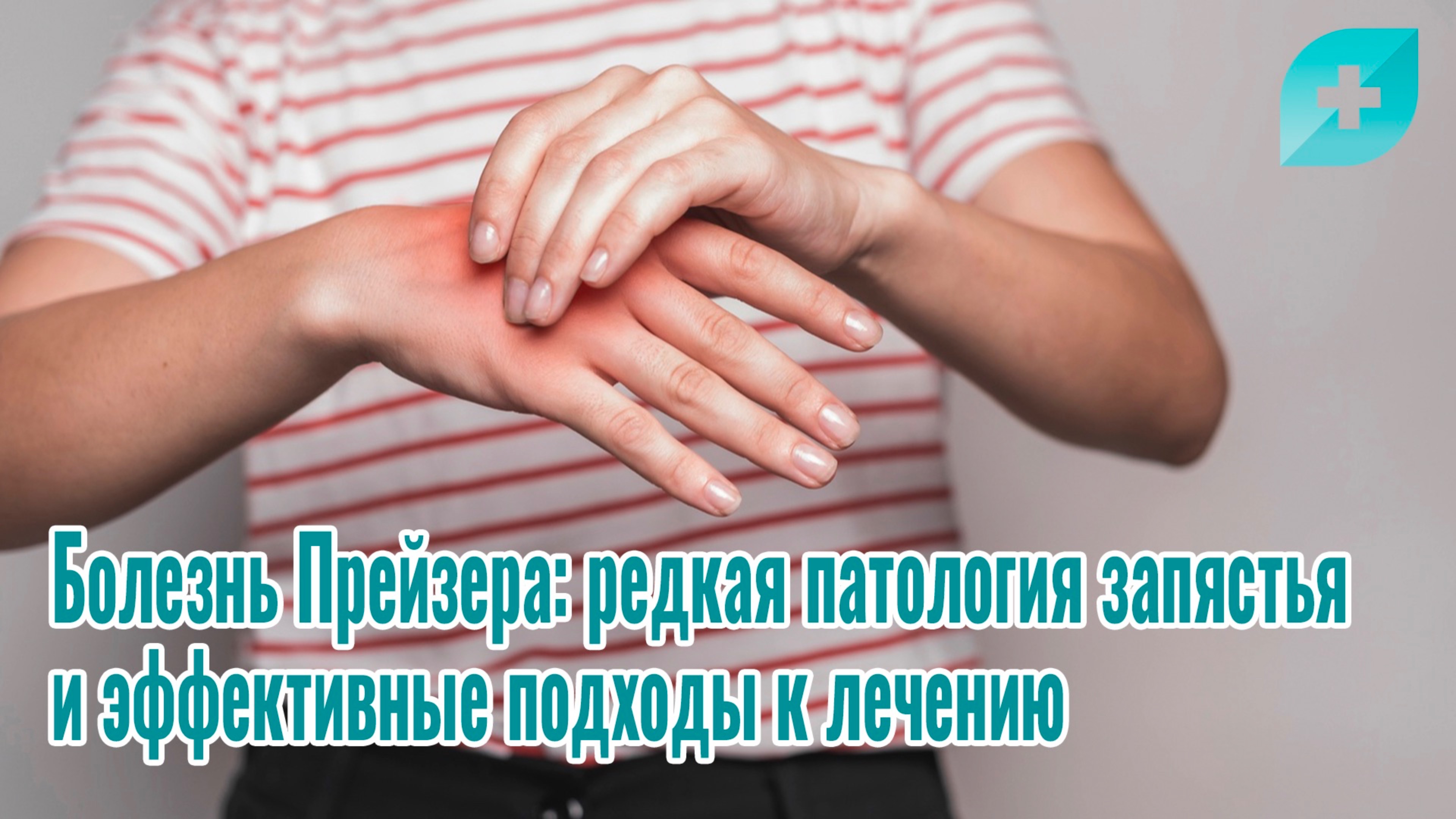 Болезнь Прейзера: редкая патология запястья и эффективные подходы к лечению