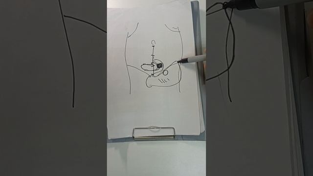 самомассаж живота по Огулову.mp4