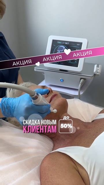 Микроигольчатый Рф-лифтинг в Екатеринбурге.