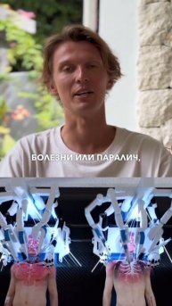 ПЕРЕСАДКА ГОЛОВЫ 😧