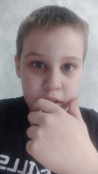 Я спалил лицо... Спасибо за 15 подписчиков.