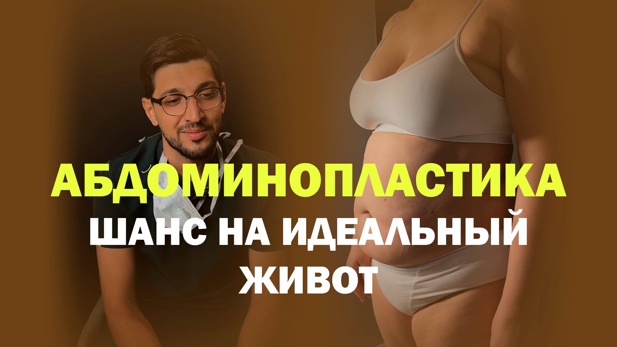 Комплексная операция: липосакция и абдоминопластика — результат через 4 месяца
