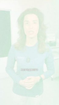 ПЕРЕСАДКА ЗУБА - Аутотрансплантация/ 🆘+7-499-951-03-03 Беспл