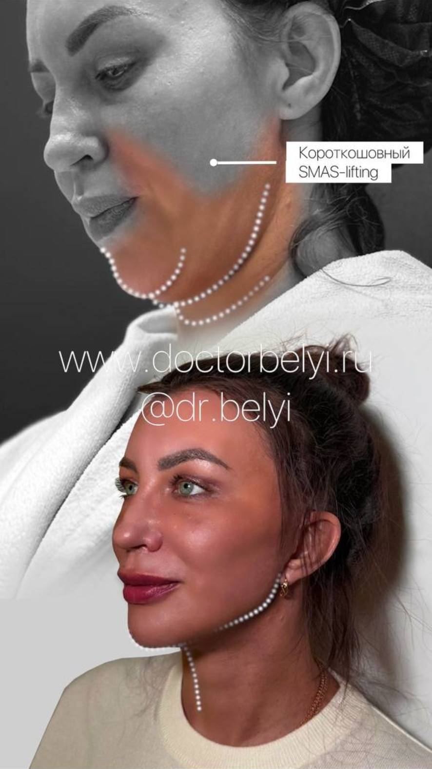 plastic surgery #2