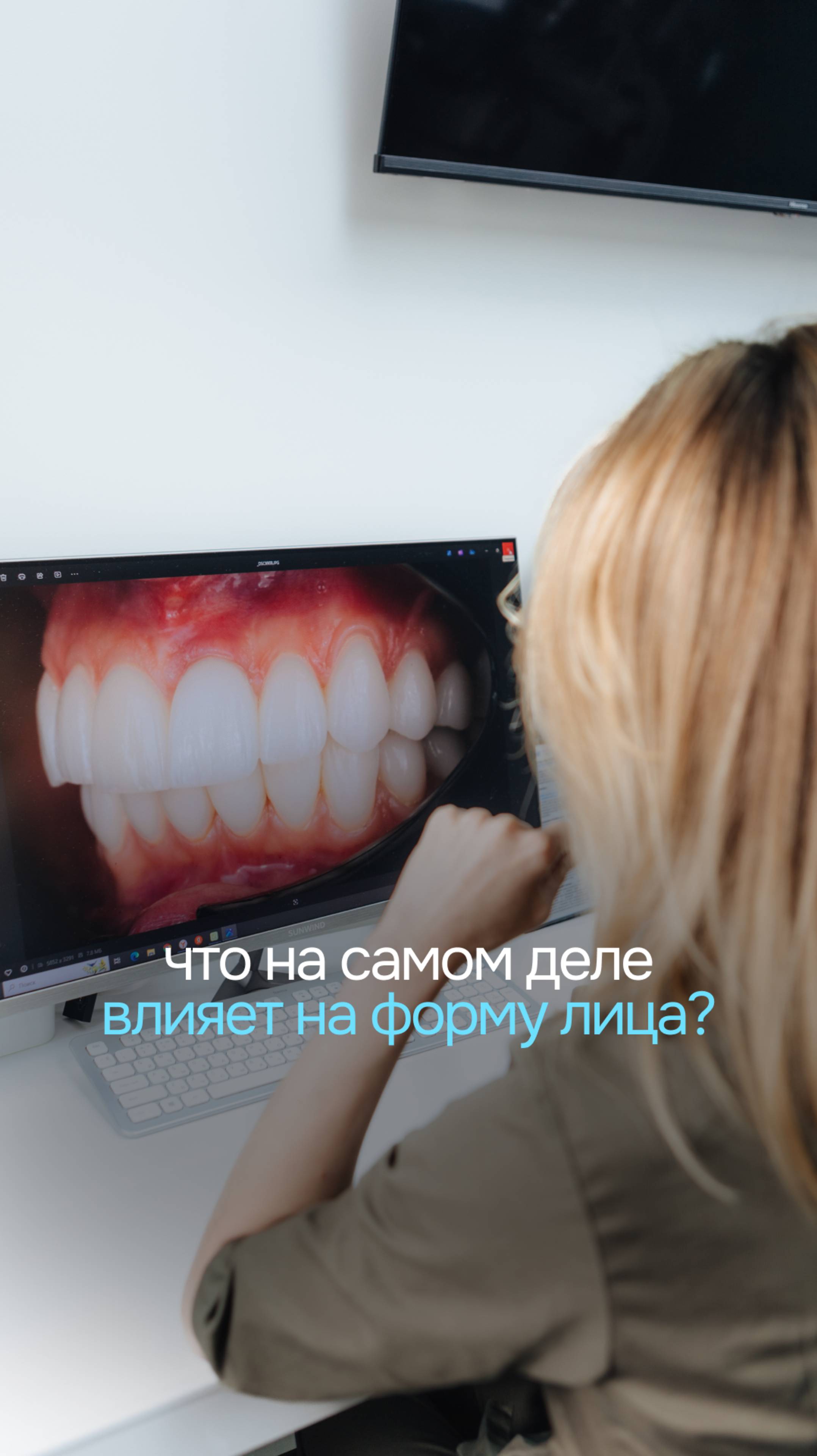 Челюсть может "регрессировать" всего за одно поколение. Но действительно ли всё так просто?