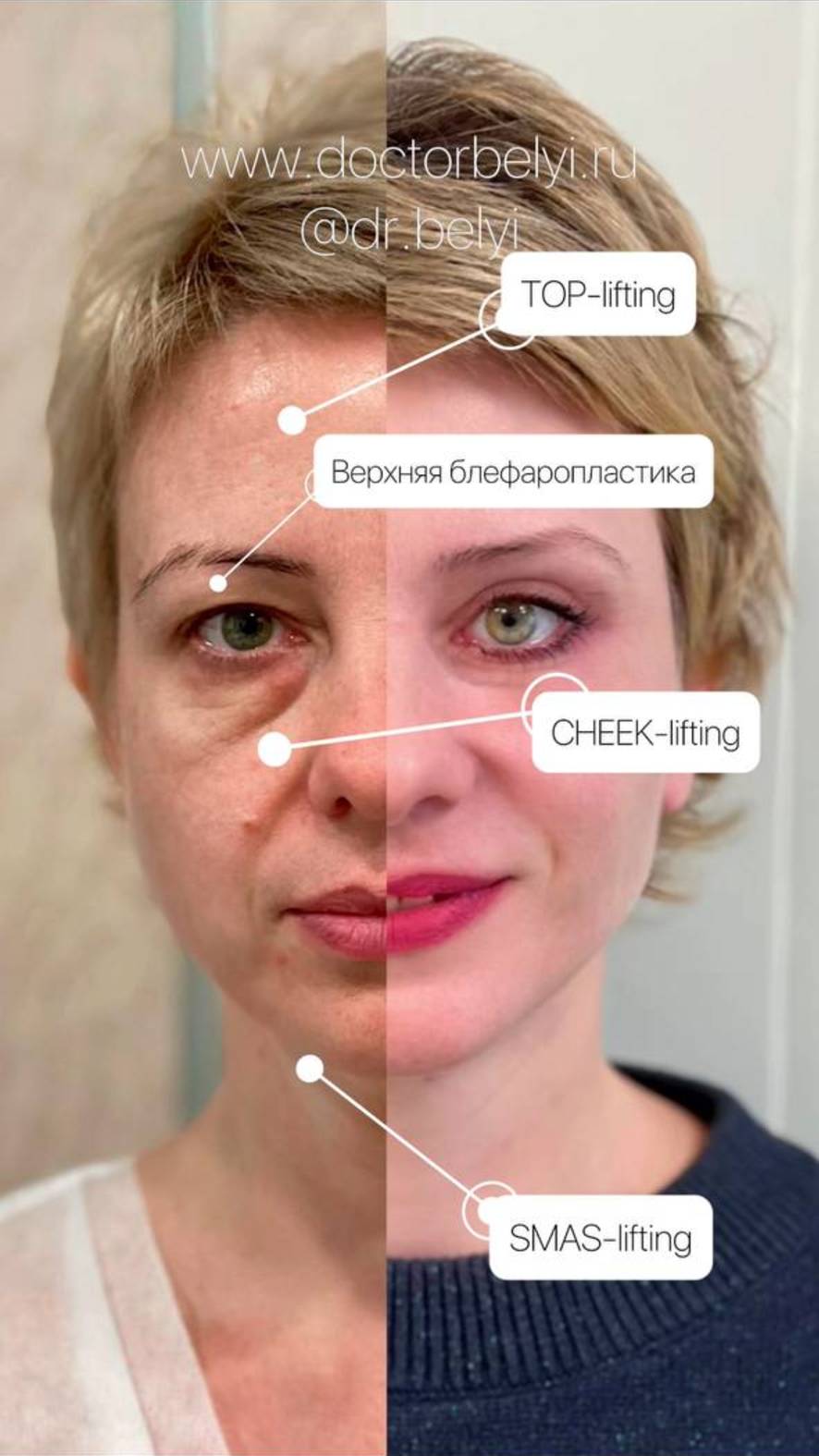 plastic surgery #1