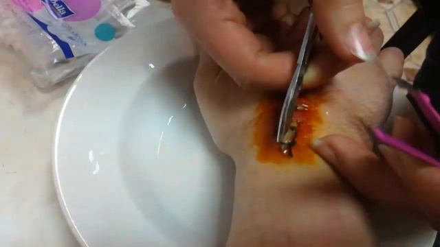 Прикол как снять шов 1я часть